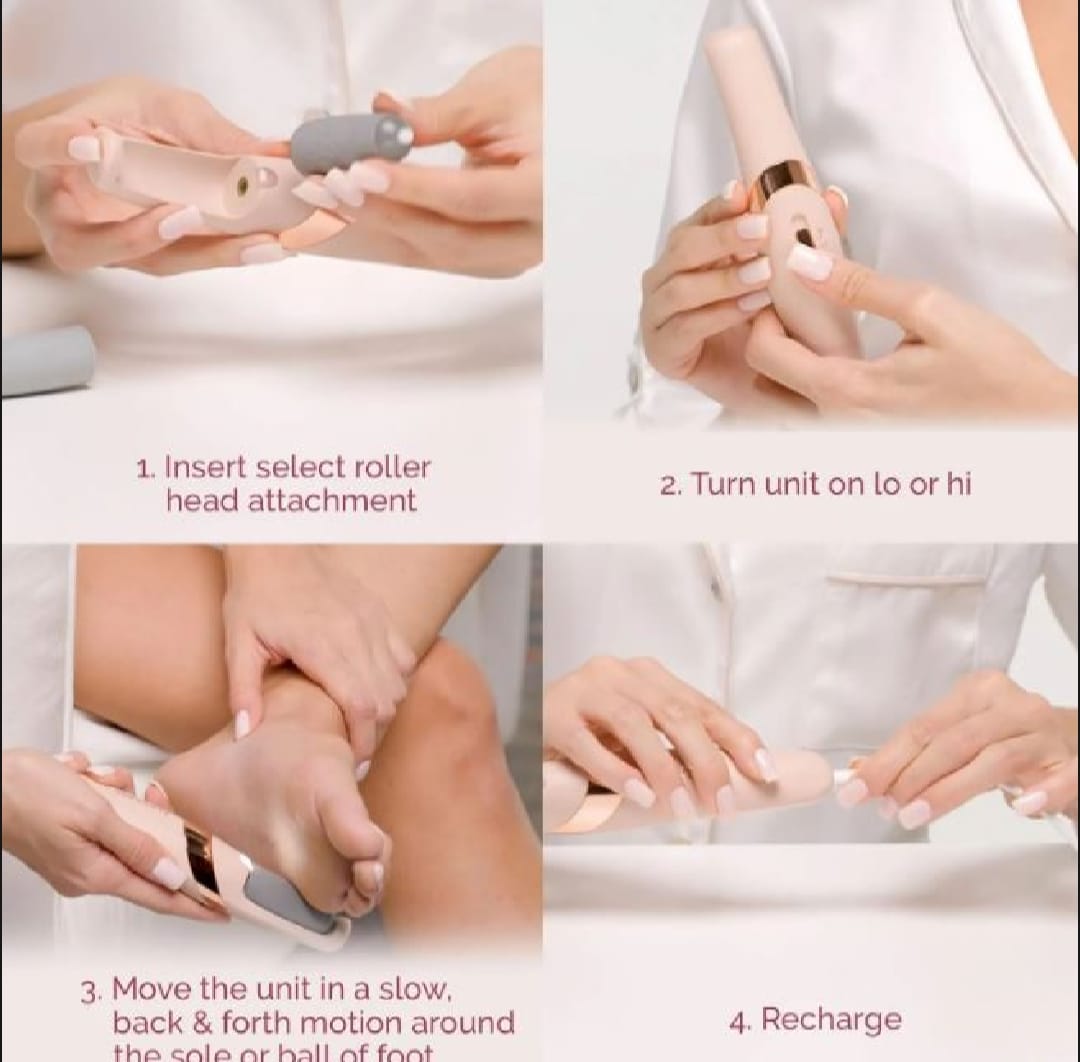 Electric Foot Callus Remover – Rechargeable Pedicure File for Dead Skin, Cracked Heels & Smooth Feet